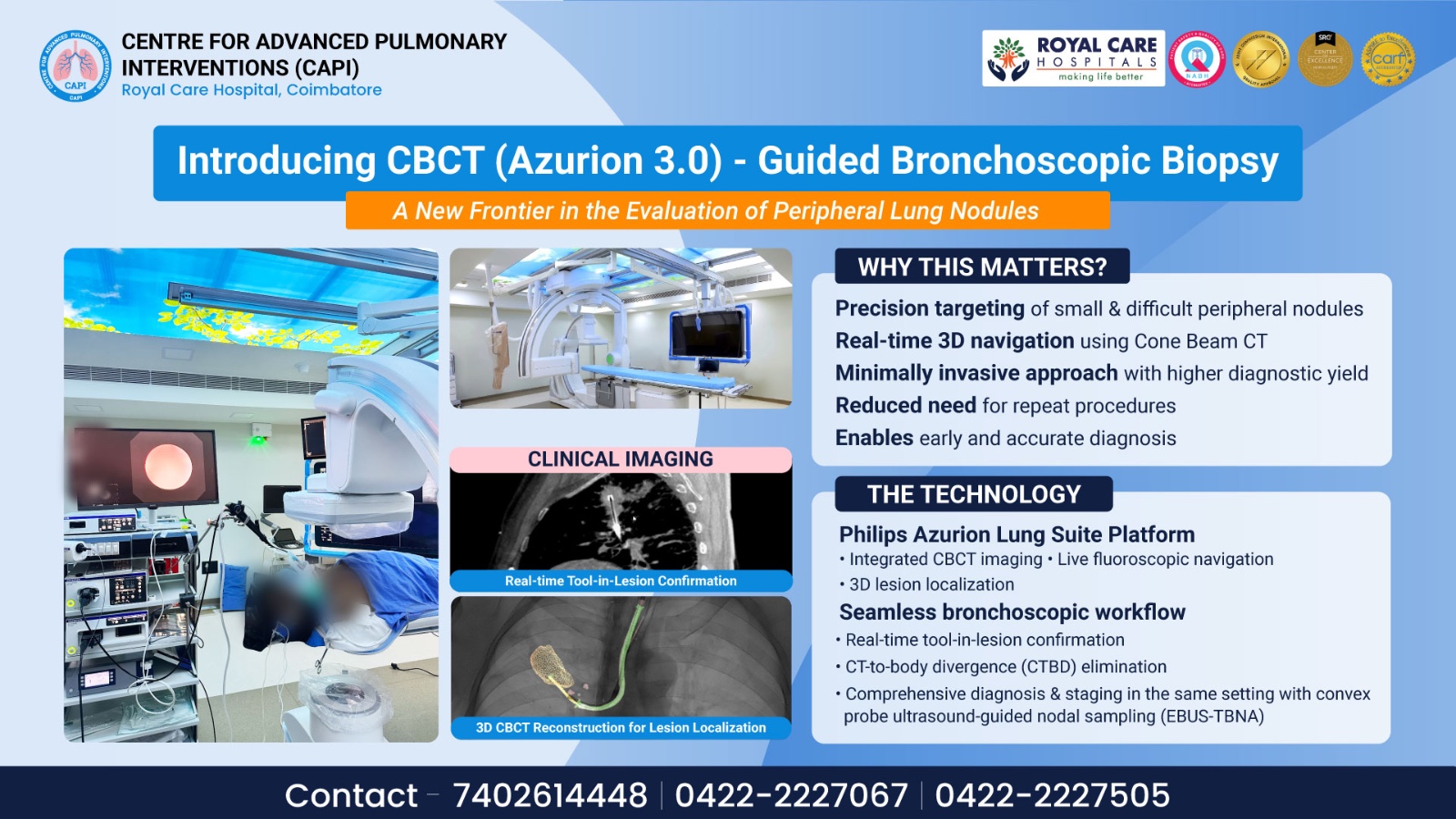 Introducing CBCT (Azurion 3.0) - Guided Bronchoscopic Biopsy at Royal Care Hospitals